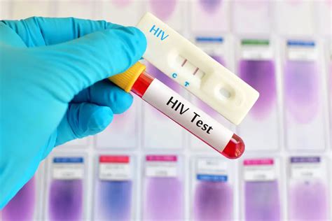 Cannock STI HIV Testing 